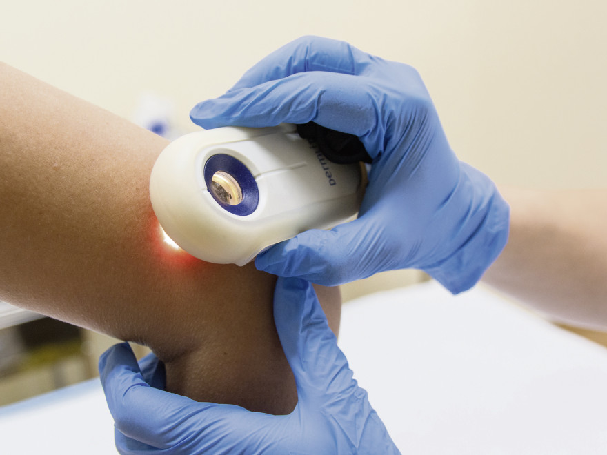 Cum ne ingrijim corect alunitele in sezonul estival