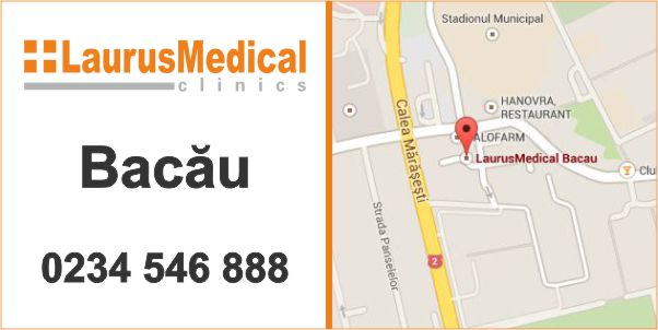 tratament ulcer varicos bacau