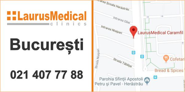 tratament ulcer varicos bucuresti