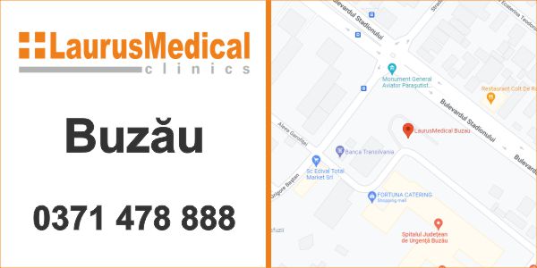 chirurgie generala buzau