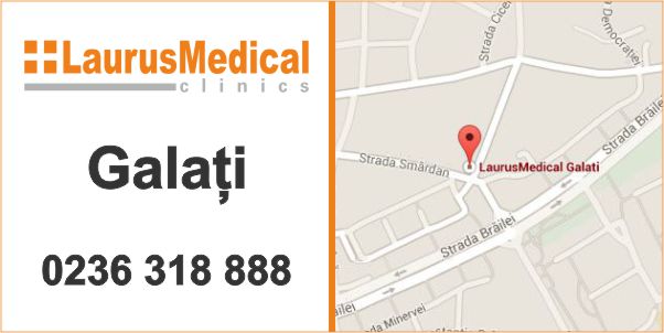 tratament ulcer varicos galati