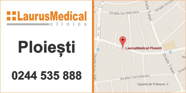 tratament ulcer varicos ploiesti