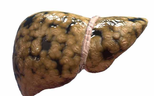 ficat dupa consumul de alcool