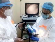 polipii rectocolonici