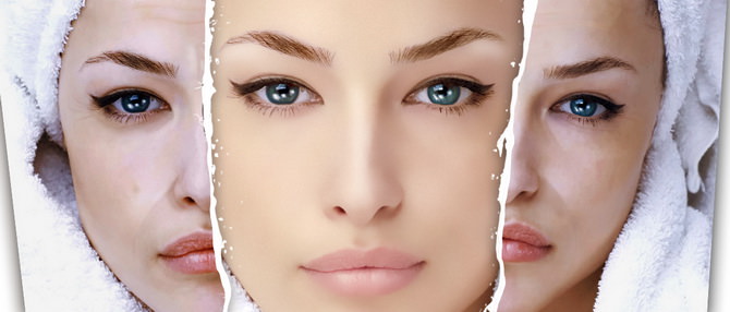 tratament peeling laurusmedical