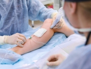 varicele si tratmentul lor